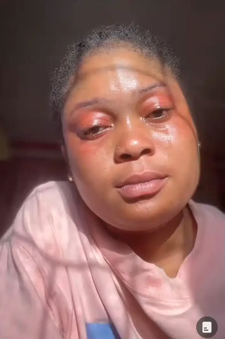 Lady in tears as she shares transformation after meeting boyfriend