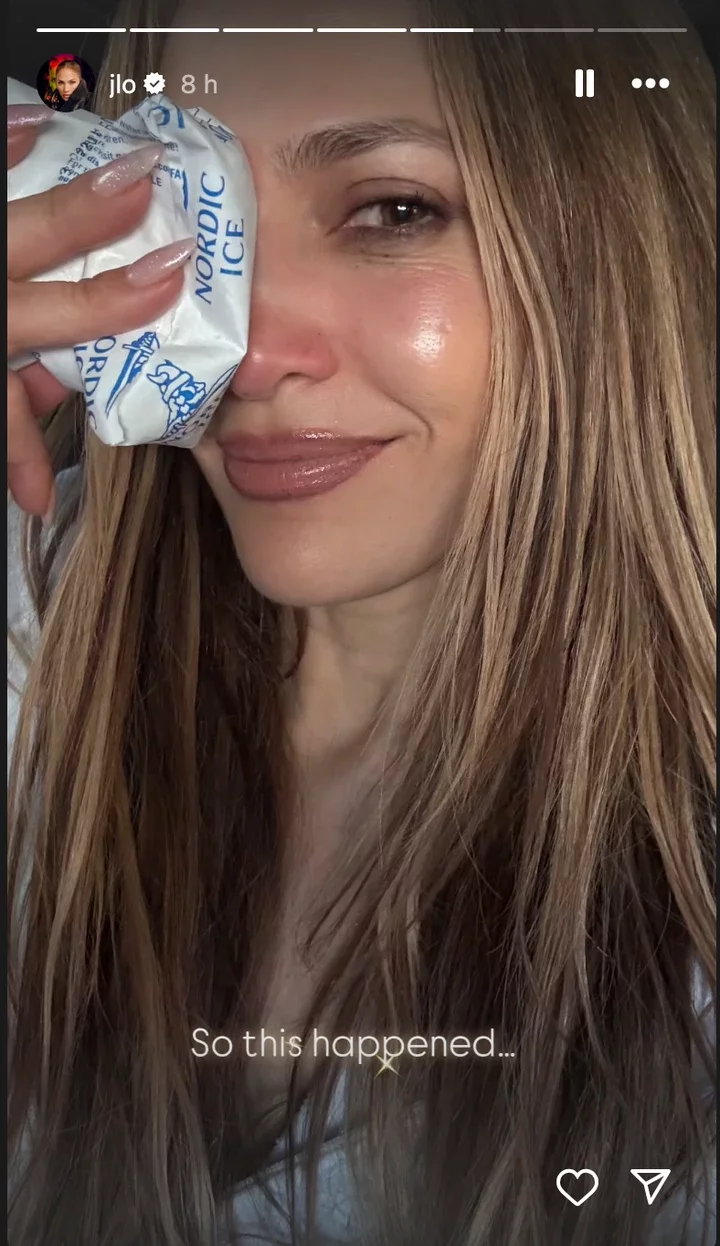 Singer said 'a whole lotta ice' had been involved in her recovery