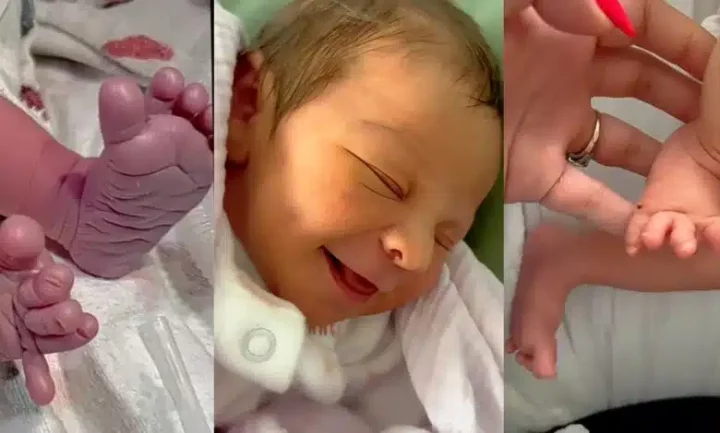 Emotional video as baby's unusually shaped leg gets amputated, replaced with prosthetic