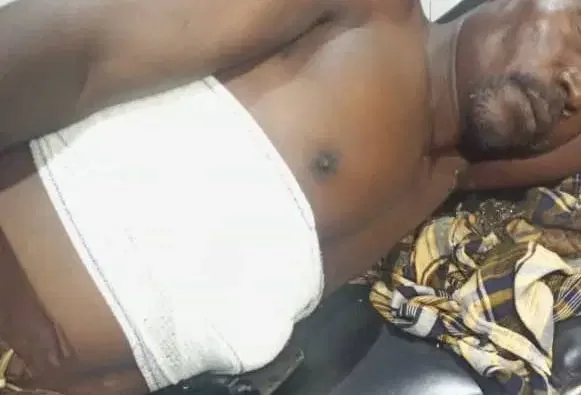 Native doctor injures self in failed bulletproof charm experiment in Abuja