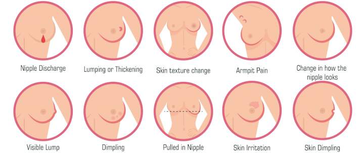 Three Steps To Self-Exam The Breast