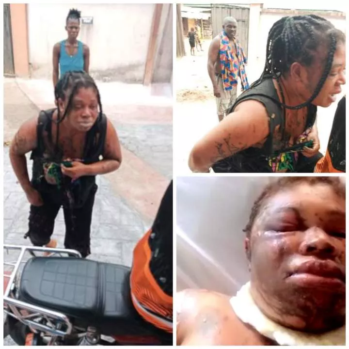 Man reportedly pours acid on his wife in Rivers