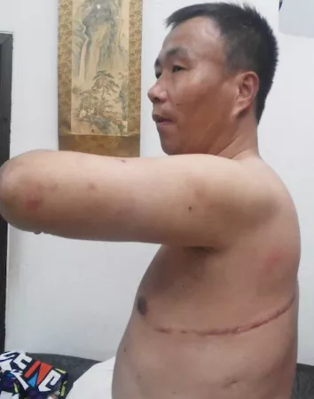 Chinese organ harvesting victim woke up chained to bed with parts of liver and lung missing