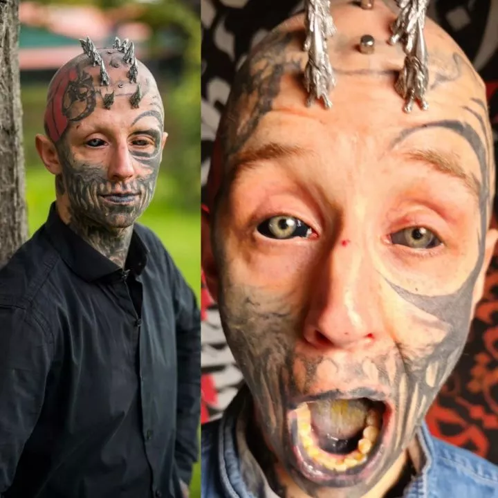 Man working on becoming reptilian by getting silicone inserted weekly in his skull