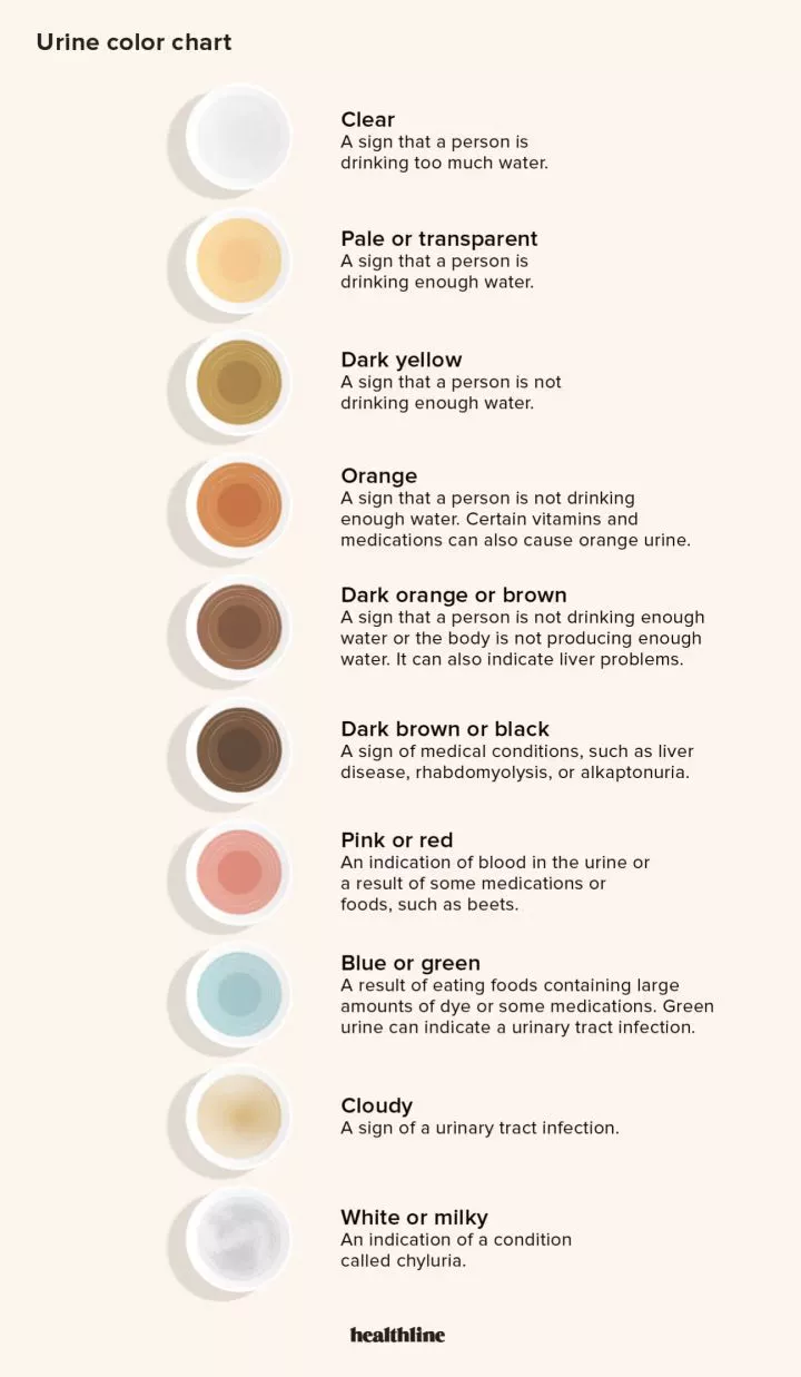 Urine color chart