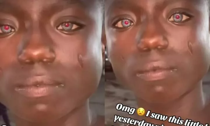 Lady amazed as she sees little boy with unique red and blue eyes