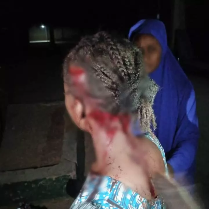 UNIMAID student viciously attacks 21-year-old lady for rejecting his love proposal