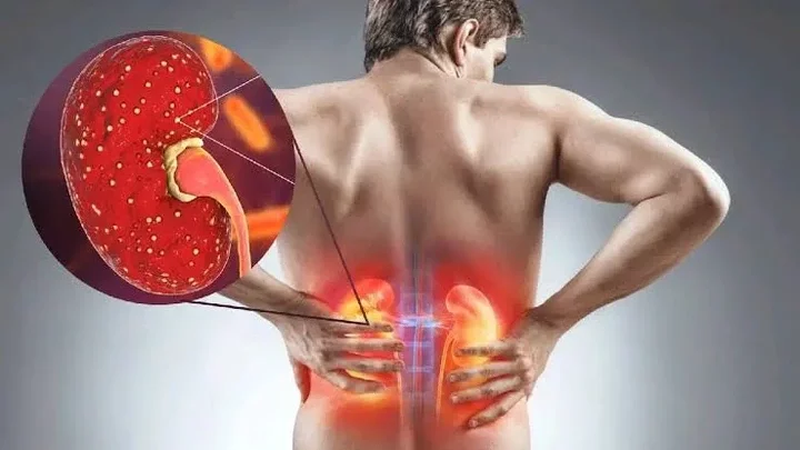 You are killing your kidney slowly with these 7 practices