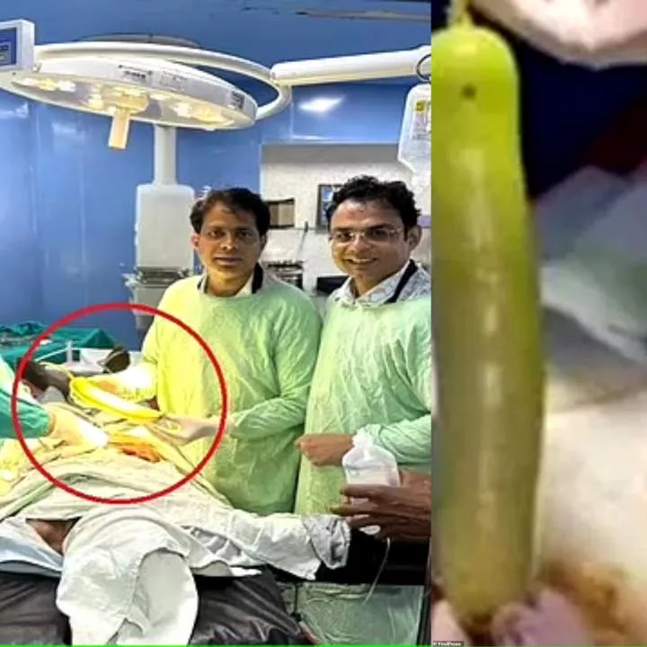 Doctors remove 18-inch long vegetable from farmer's butt after he complained of stomach pain