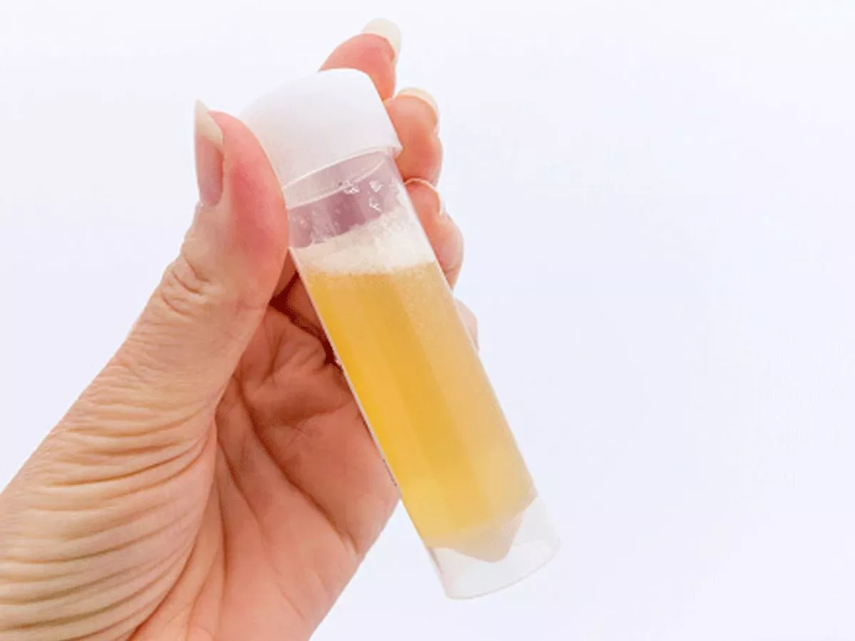 If Your Urine Always Foams, Here Are 5 Possible Causes