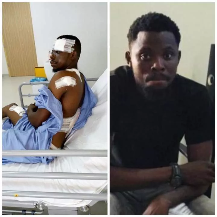 "9 bullets, 3 surgeries. God is the greatest" - Nigerian man marks seven years since he survived brutal armed robbery attack