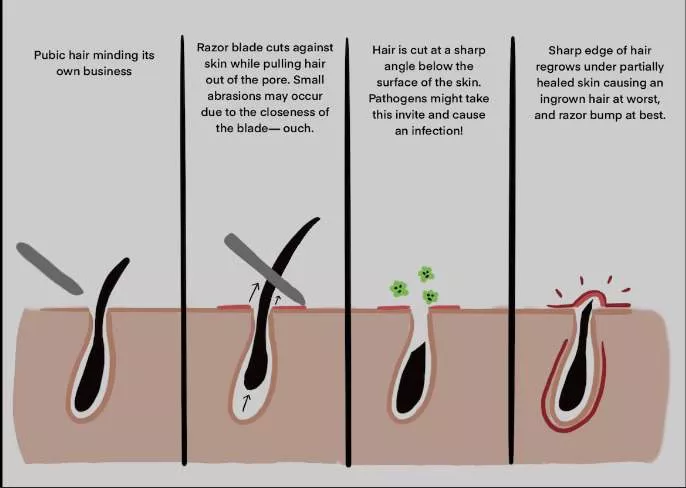 Facts about keeping your pubic hair: To shave or not to shave?