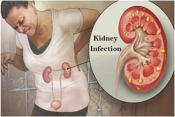 Pay Attention to Your Kidney If You Begin to Notice These Signs in Your Body