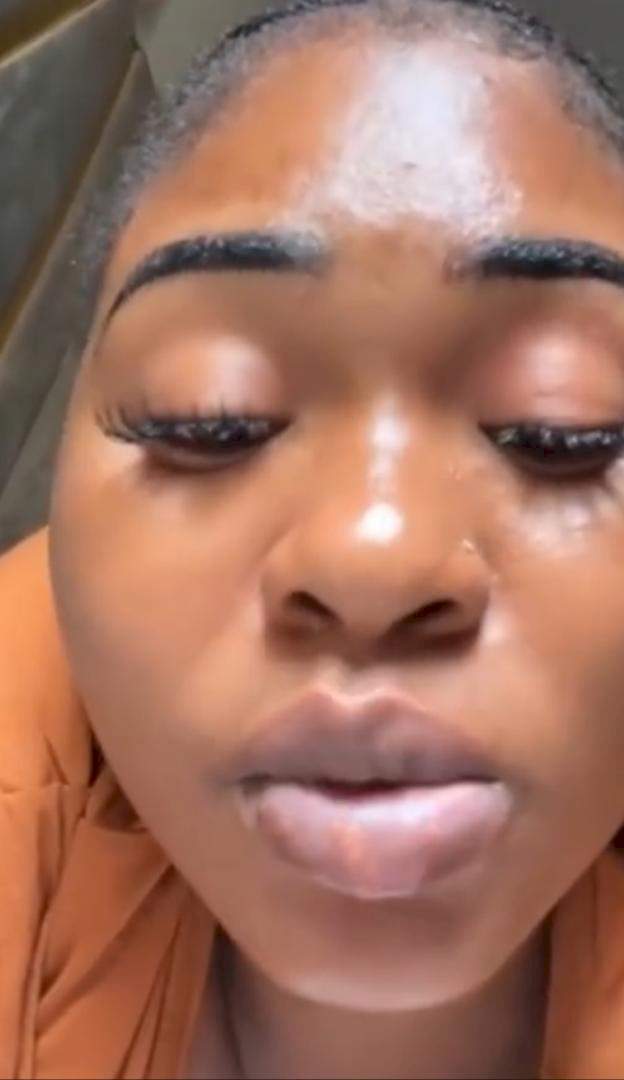 'What did I put myself into? Fine girl like me' - Lady ends up with swollen lips after pink lips procedure (Video)