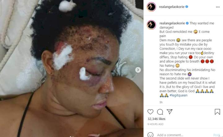 'After two years plus that I was shot, pellets still coming out' - Angela Okorie recounts her near-death experience with gunmen
