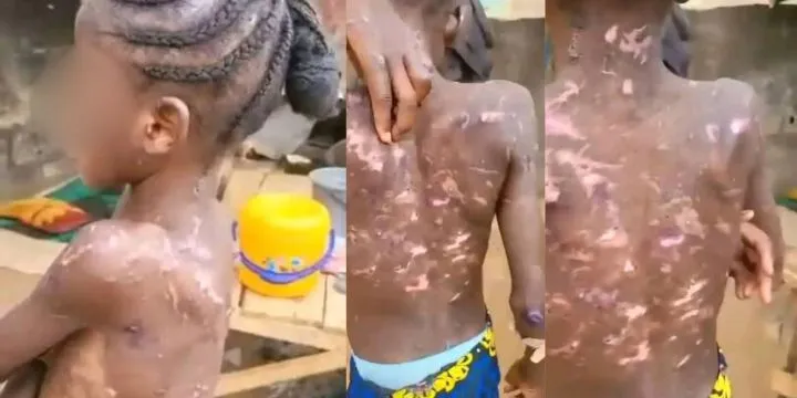 Abuja CP Orders Arrest of Woman Accused of Abusing And Burning Her Maid Abuja CP Orders Arrest of Woman Accused of Abusing And Burning Her Maid