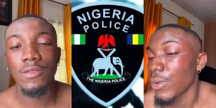 Man cries out after Owerri police drag him to bush in illegal search, extort ₦30,000 Man cries out after Owerri police drag him to bush in illegal search, extort ₦30,000