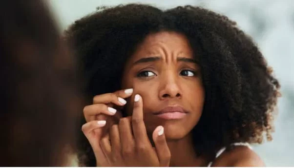 How To Fade Scars With Milk | Fab.ng