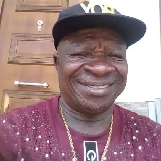 'Because of my face, nobody agreed to carry me when I was born' - Uwaezuoke