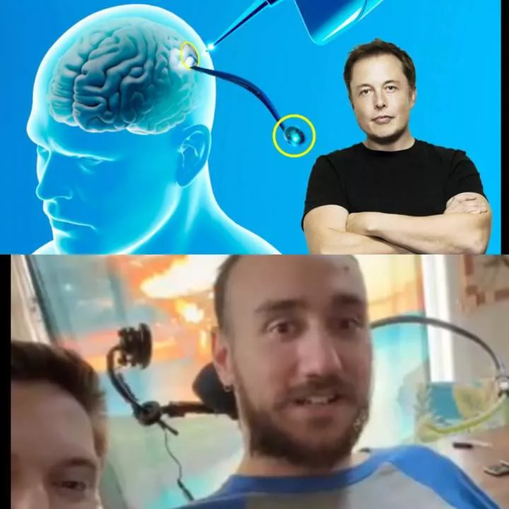 "Can't even describe how cool it is" - First human with Elon Musk's Neuralink brain chip demonstrates moving cursor with his mind (video)