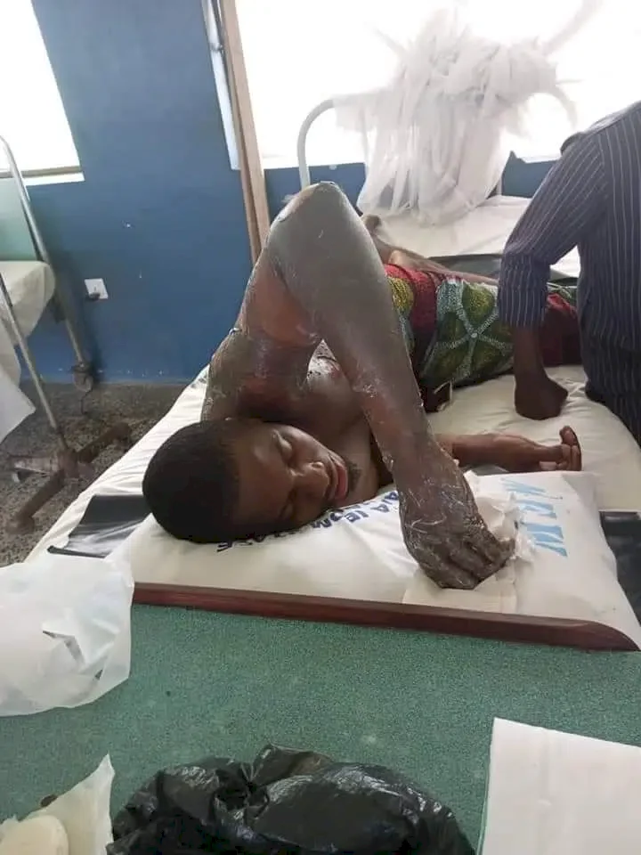 AKSU student hospitalized after he was allegedly set ablaze by community resident amid fierce argument