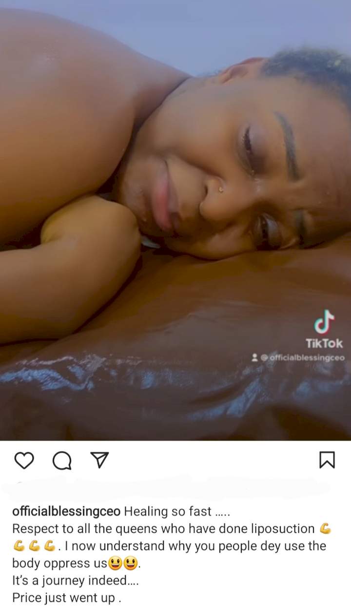 'It's so painful' Blessing Okoro cries out in pain as she undergoes post-op care following liposuction surgery
