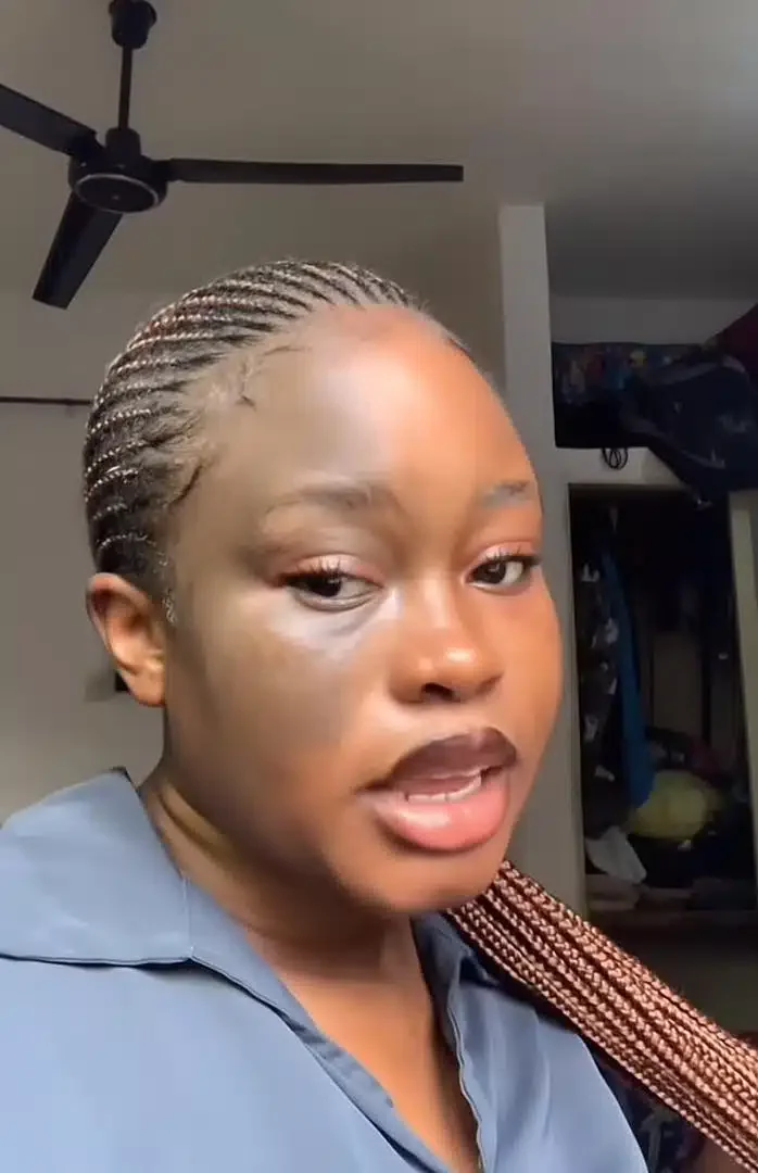 'Some people think I bleached my face' - Lady confidently flaunts birthmark