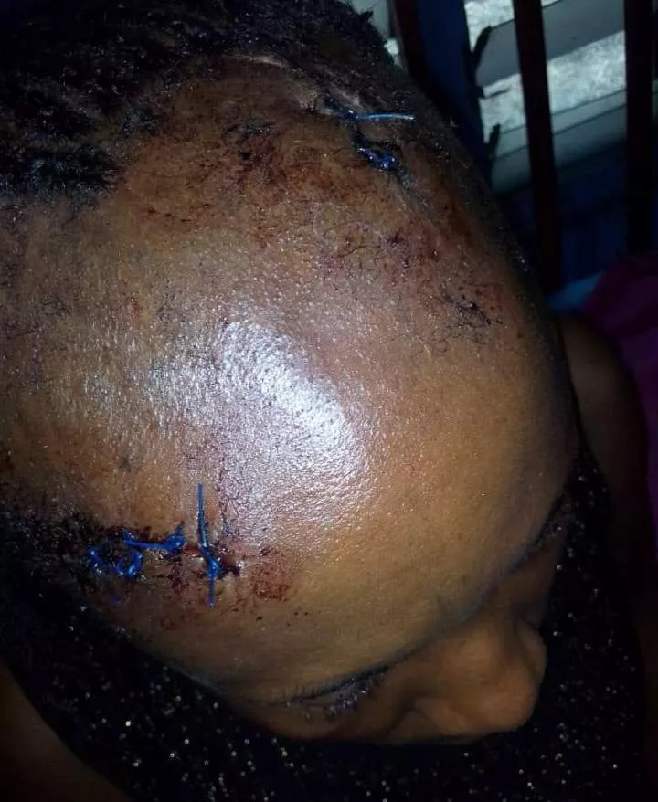 Rivers police arrest fleeing landlord who allegedly attacked tenant and her husband with machete after she rejected his advances