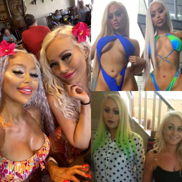 Twin sisters reveal how they spent $200K on bo0b, butt and vagina surgeries to look like Barbies (photos)