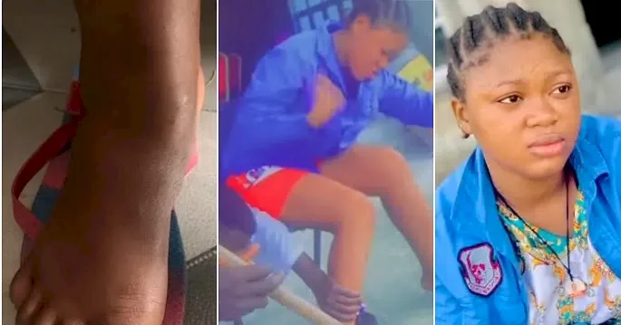"Avoid fake friends" - Lady shares survival story after getting poisoned by female friend (Video)